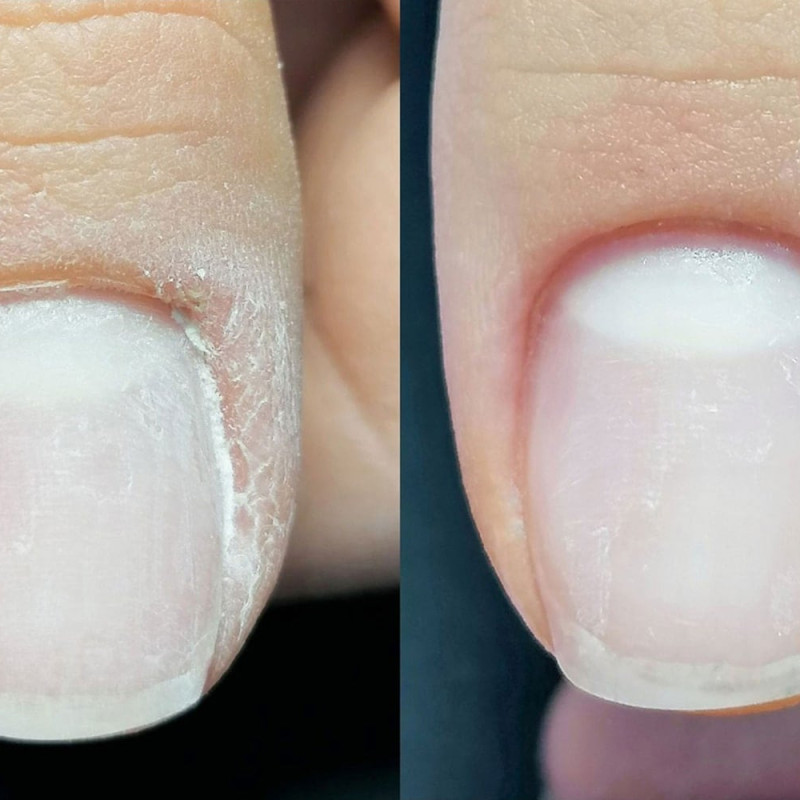 Combi Manicure -ενίσχυση φυσικού- Basic NailArt - SKU 800001